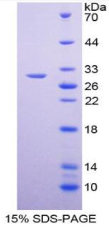 SDS-PAGE (Gata1-474M).jpg